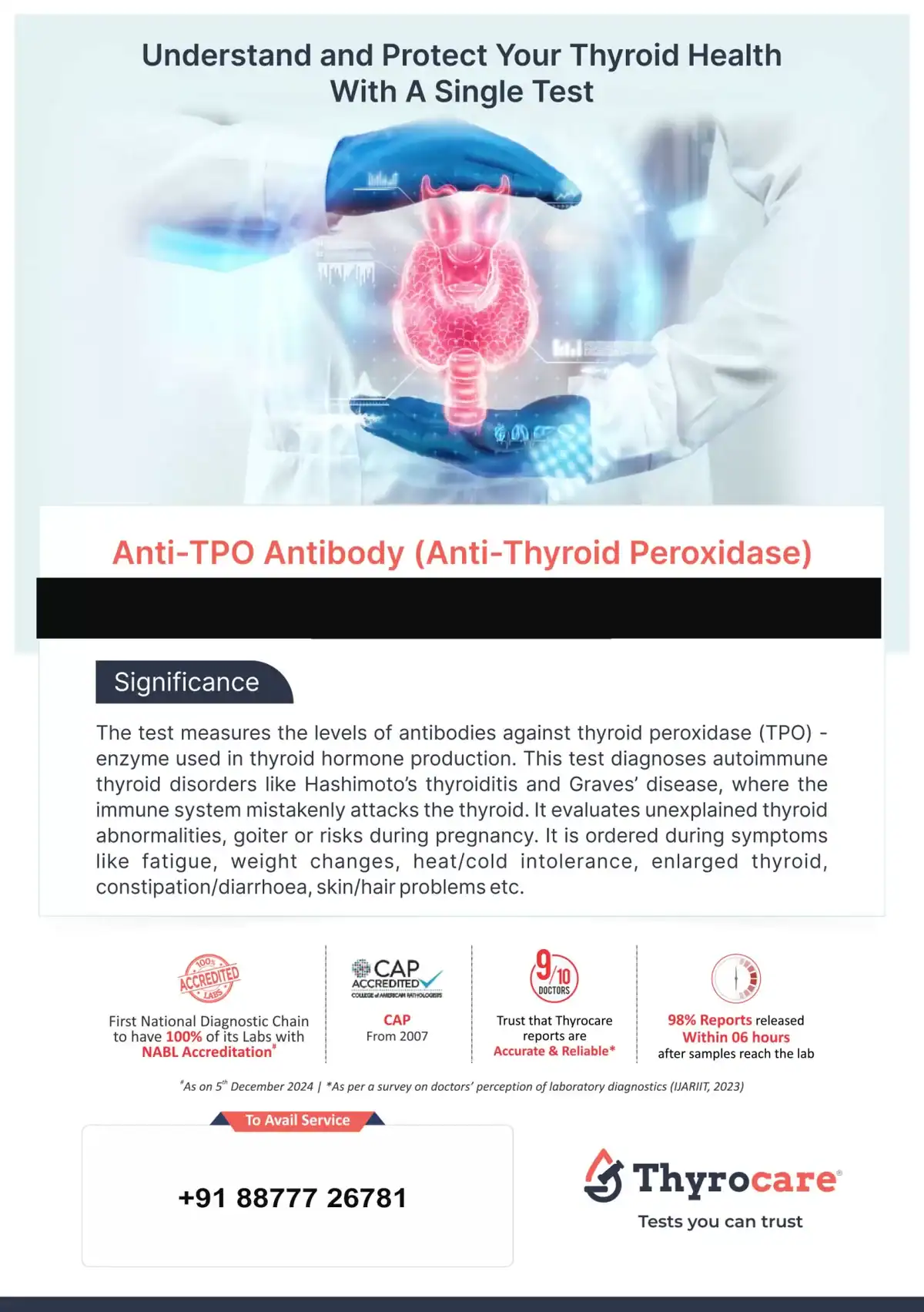 Anti-TPO Test Anti-TPO Antibody Blood Test