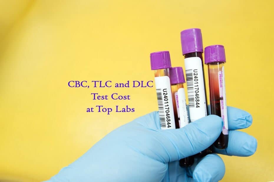 CBC Test Price in Jamshedpur