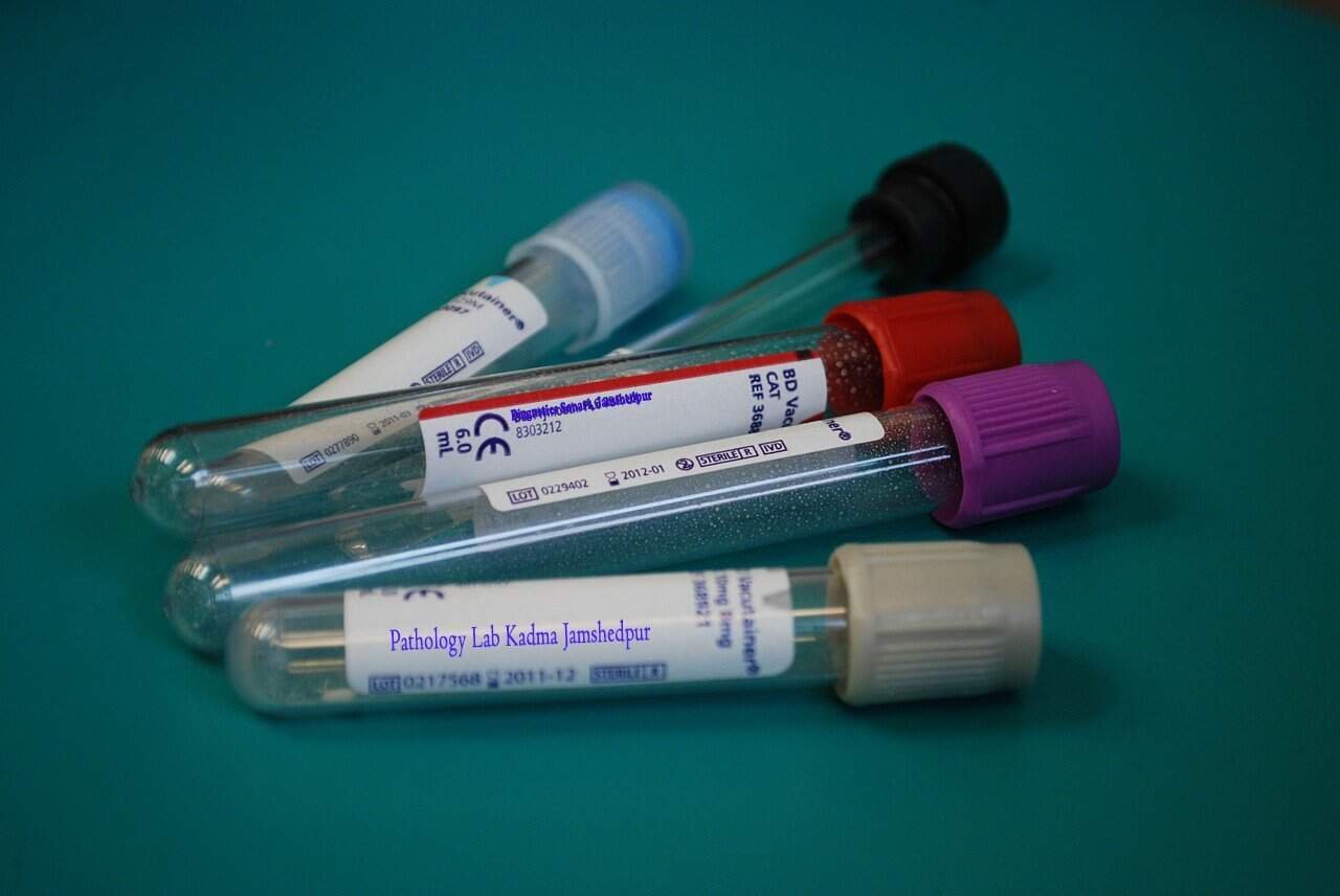Top 25 Pathology Labs & Diagnostic Centers in Sakchi, Jamshedpur All blood test price in Jamshedpur