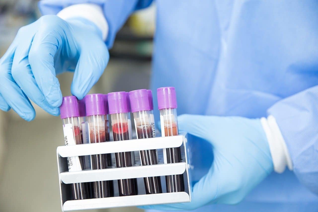 Top 25 Pathology Labs & Diagnostic Centers in Sakchi, Jamshedpur pathology lab test