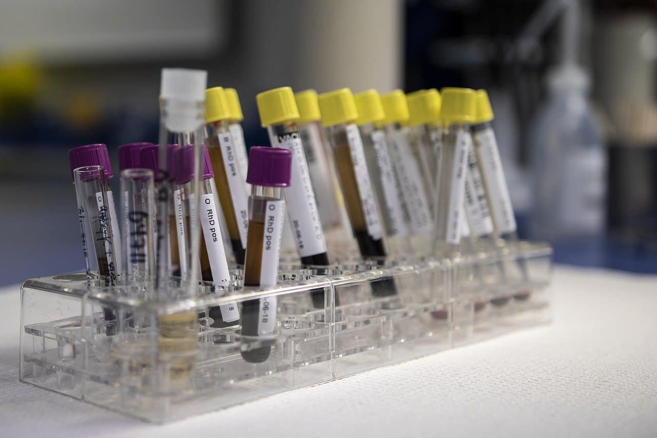 Top 25 Pathology Labs & Diagnostic Centers in Sakchi, Jamshedpur pathology blood and urine testing