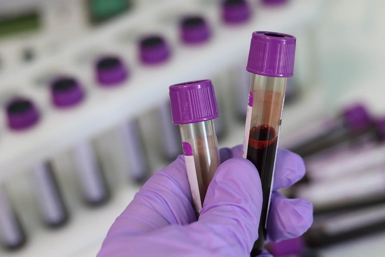 Top 25 Pathology Labs & Diagnostic Centers in Sakchi, Jamshedpur pathology testing center