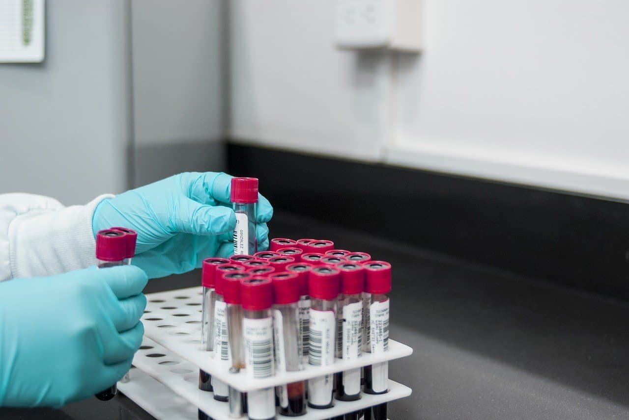 Top 25 Pathology Labs & Diagnostic Centers in Sakchi, Jamshedpur blood test at home service
