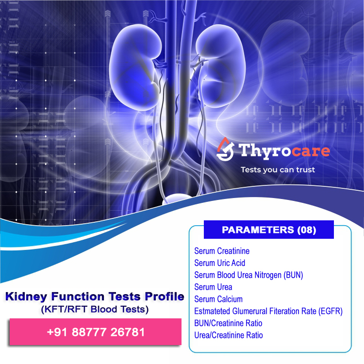 KFT/RFT Test Parameters in Jamshedpur