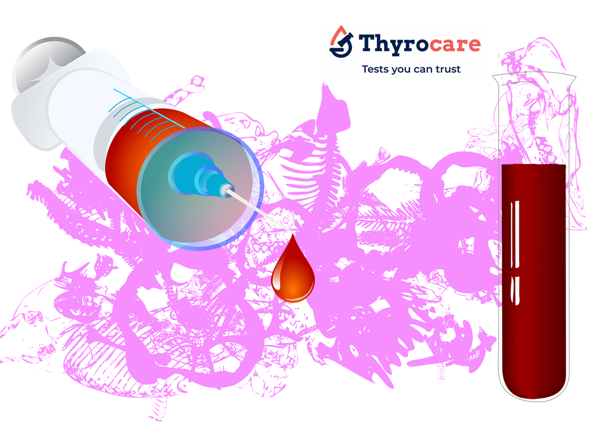 Calcium blood test - Thyrocare Jamshedpur