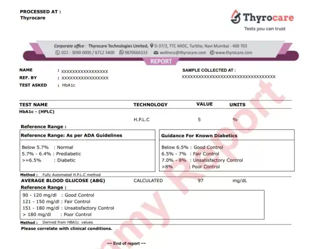 HbA1c Test at ₹360 Only with Free Home Collection HbA1c Test Report
