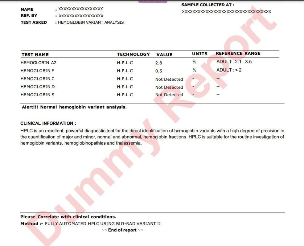 HPLC Test in Jamshedpur at ₹799 - Thyrocare Jamshedpur HPLC Test Report