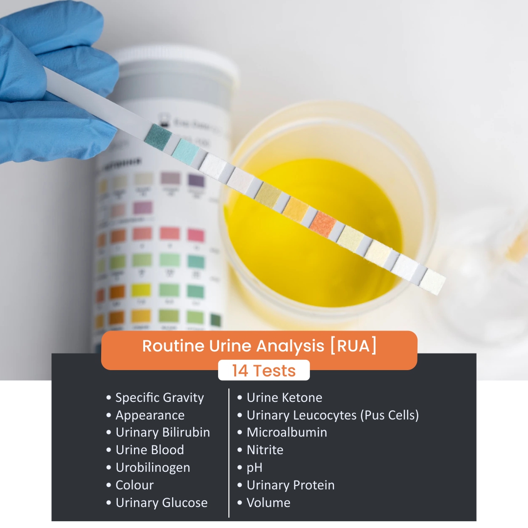 Urine Routine Examination