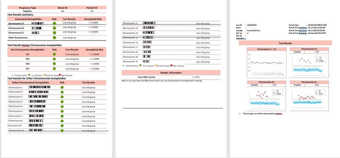 Non Invasive Prenatal Testing (NIPT) in Jamshedpur NIPT test in Jamshedpur - sample report