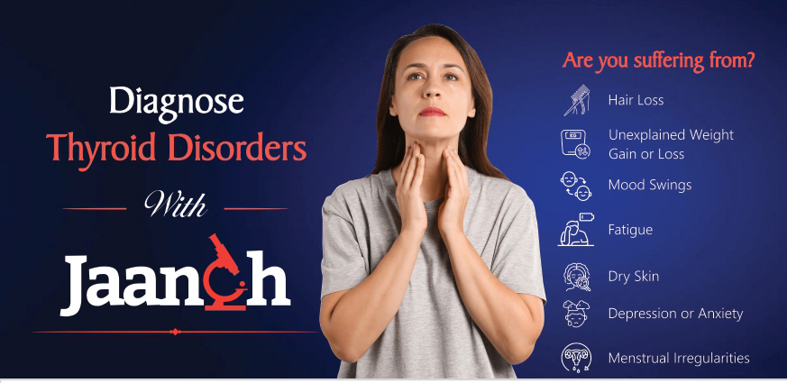 Jaanch thyroid function tests (TFT) by Thyrocare