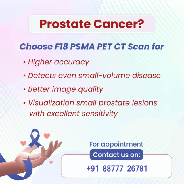 PET CT scan for prostate cancer
