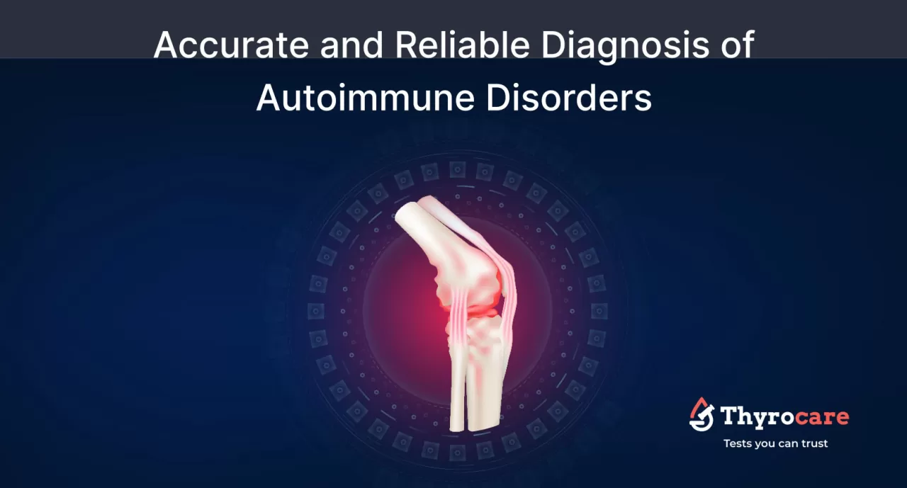 ANA Profile Test at the Best Price: ENA Profile Test 17/18 Blot 1 ANA Profile Test - ENA Profile Test - Extractable Nuclear Antigen Test Blot for Arthritis and Autoimmune Disorders, including HLA-B27 dsDNA Tests