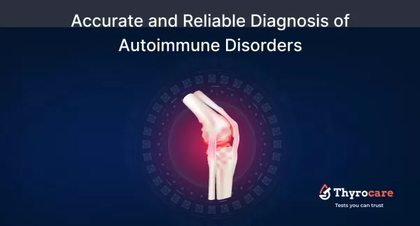 Diagnosis for autoimmune disorders - ANA Test and ENA Profile