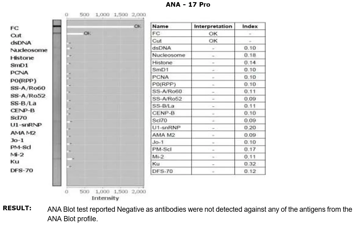 ANA Profile Test at the Best Price: ENA Profile Test 17/18 Blot 2 ANA Profile Test Report - ENA Profile Test Details
