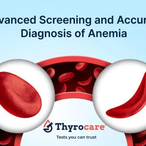 Thalassemia, Sickle Cell, HPLC, Hb Electrophoresis, and Anemia Tests Profile