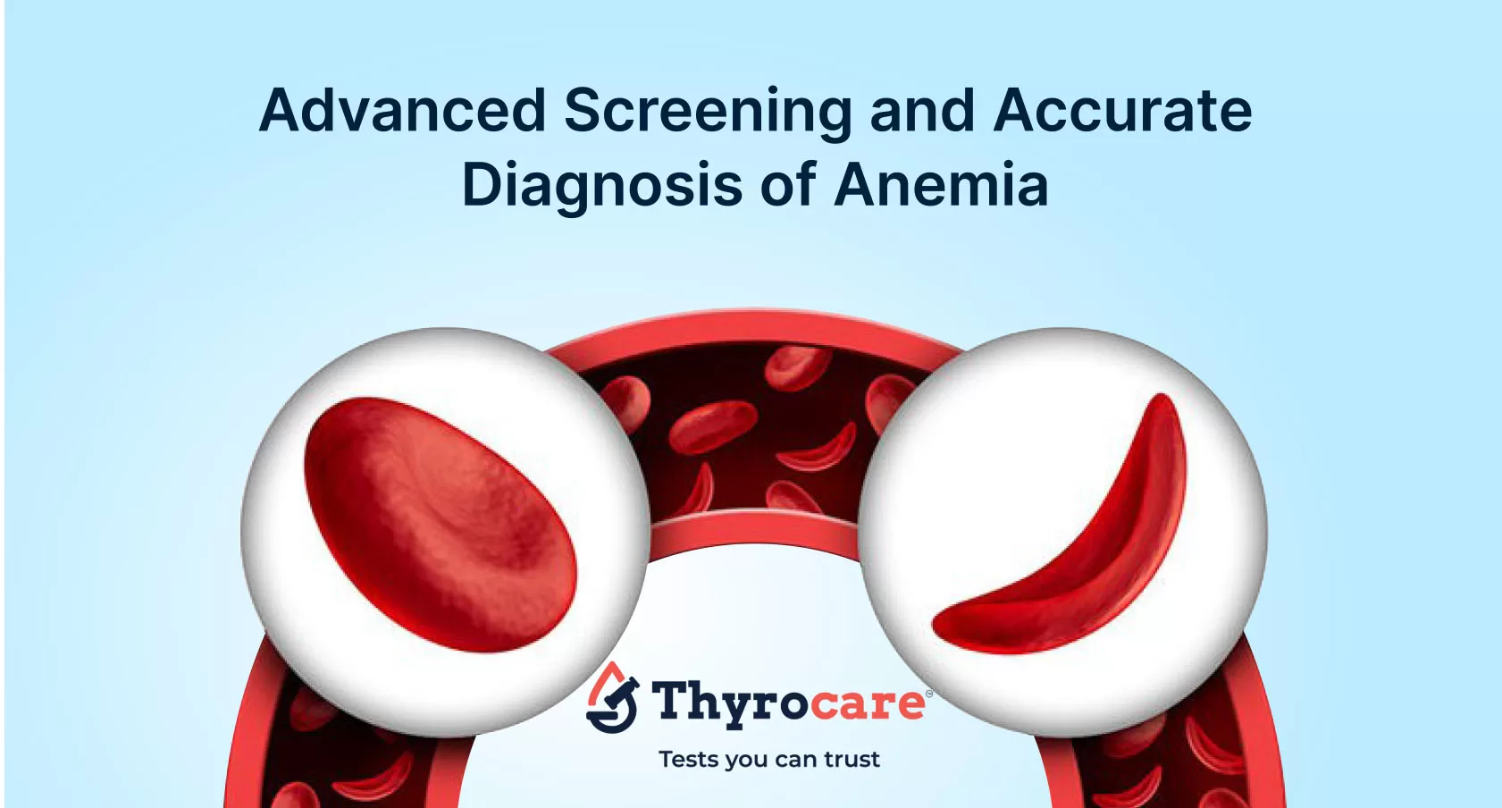 Thalassemia and sickle cell anemia test profiles