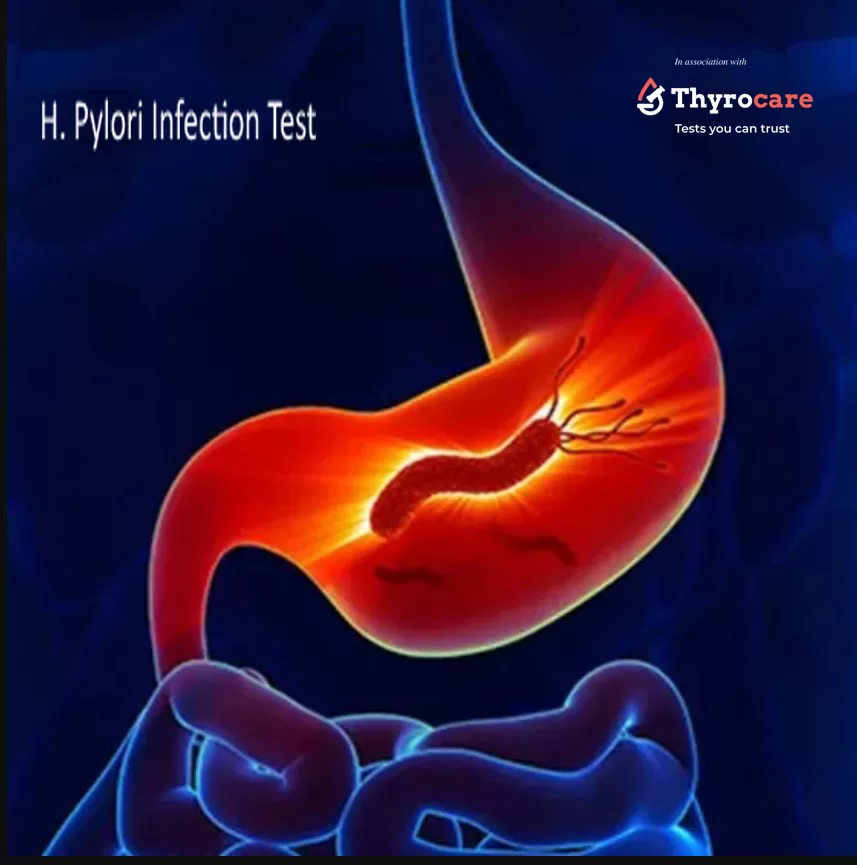 Helicobacter Pylori (H. Pylori) IgG Test at ₹1,099 2 H. Pylori Test - Helicobacter Pylori IgG, AgA, and IgM antibody tests