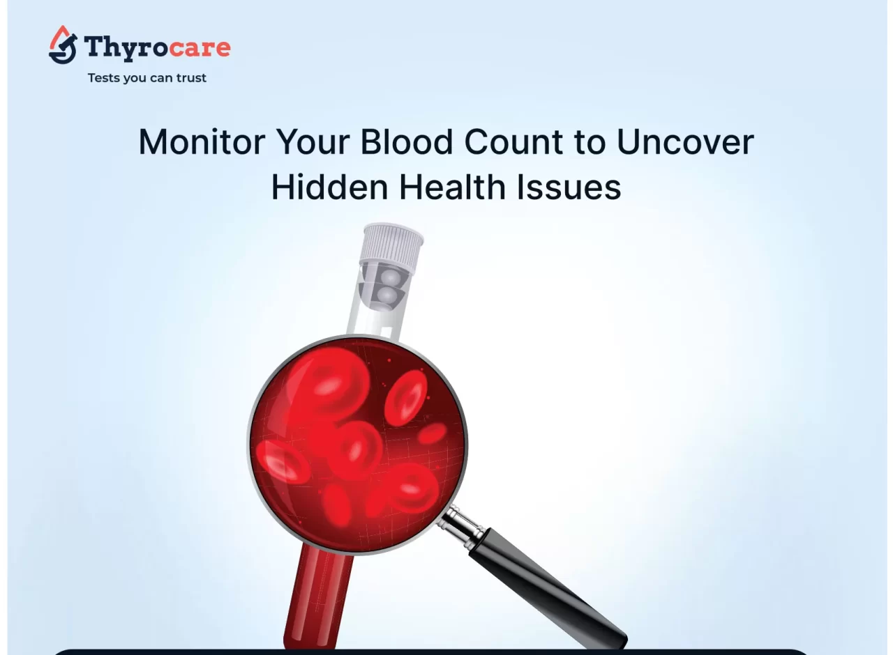 CBC Test - CBP Test - Complete Hemogram Blood Count Test