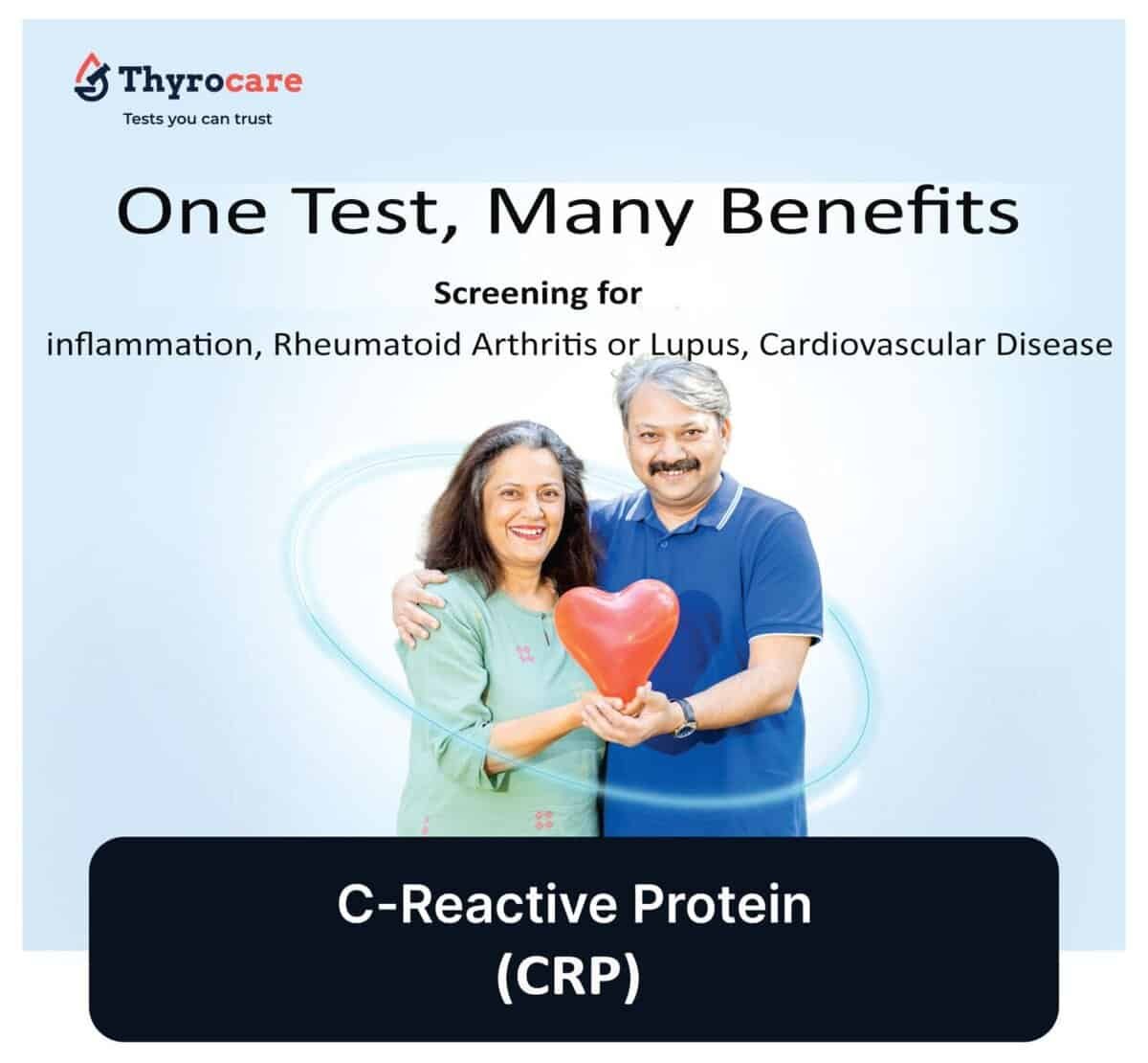 C-Reactive Protein (CRP) blood test for inflammation and cardiac risk assessment