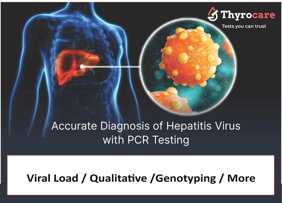 Viral load testing for hepatitis virus diagnosis with PCR testing technology.