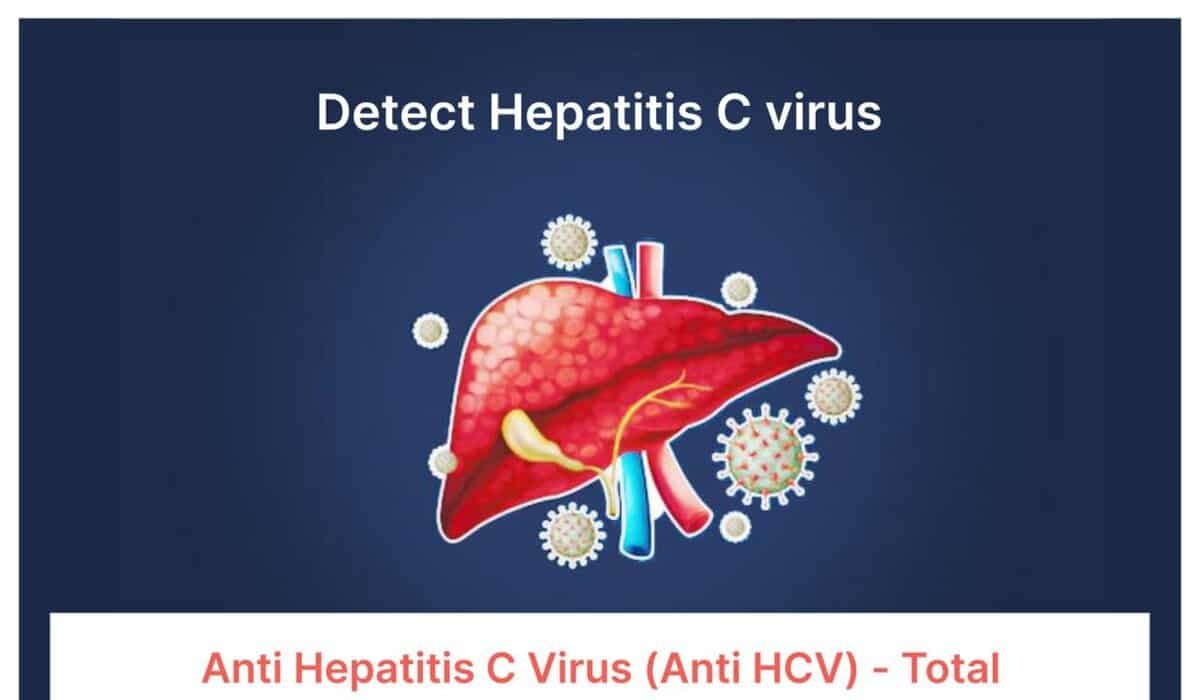Detect hepatitis C virus illustration showing liver infection and virus particles
