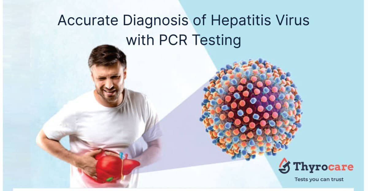 HCV RNA PCR testing for Hepatitis C diagnosis and monitoring