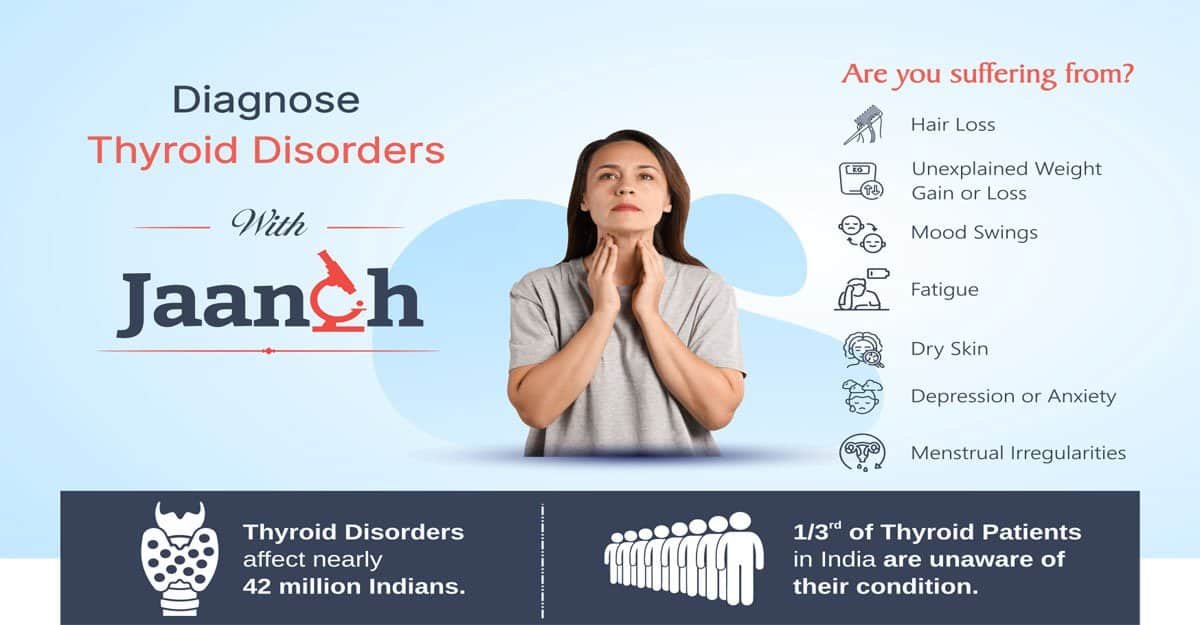 Thyroid Testing Labs & Prices in Jamshedpur All Thyroid tests, profiles and panels by Thyrocare at the best price