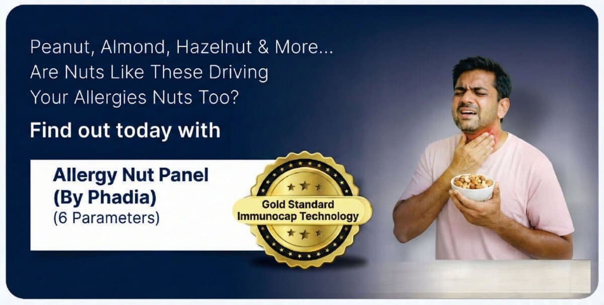 Allergy Nut Panel by Phadia (ImmunoCAP) – 6 parameters