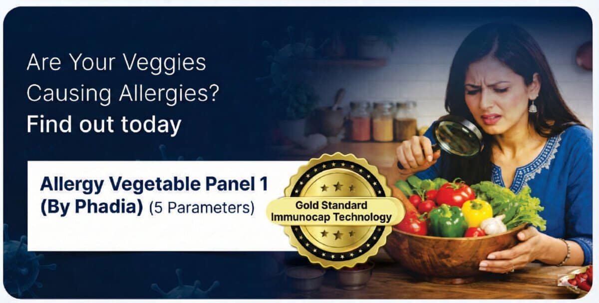 Allergy Vegetable Panel 1 by Phadia (ImmunoCAP) – 5 parameters