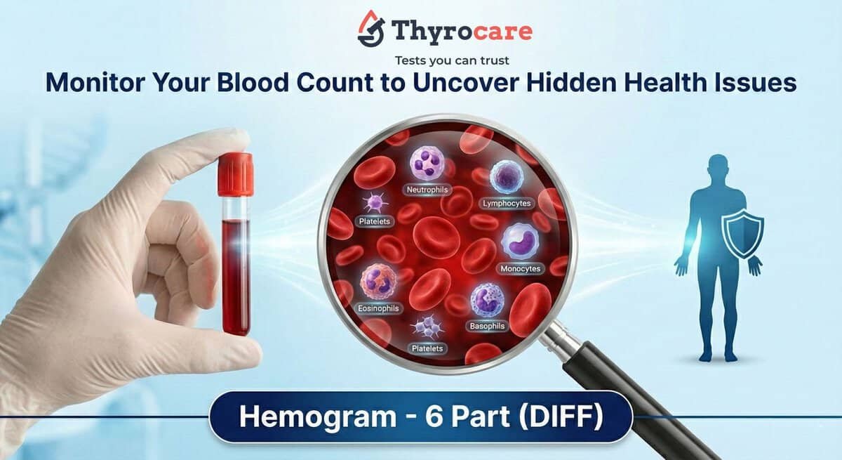 CBC Hemogram Test