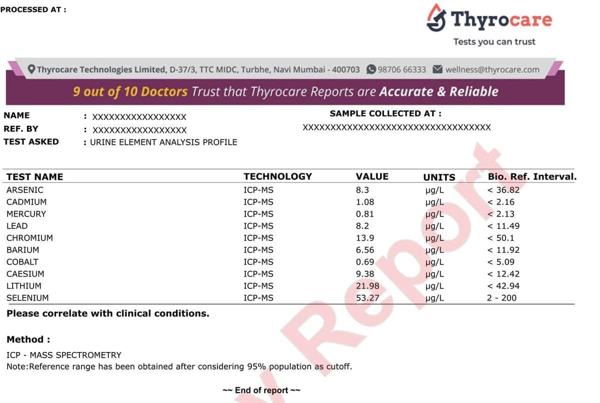Sample report format for the Heavy Metal Urine Test panel