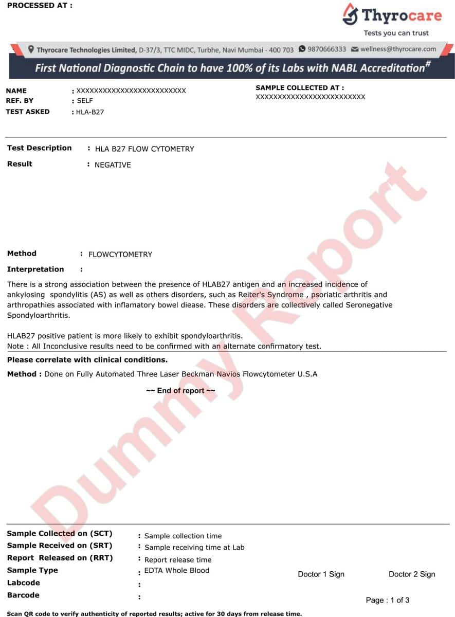 Sample HLA B27 Blood Test Report showing Positive or Negative status