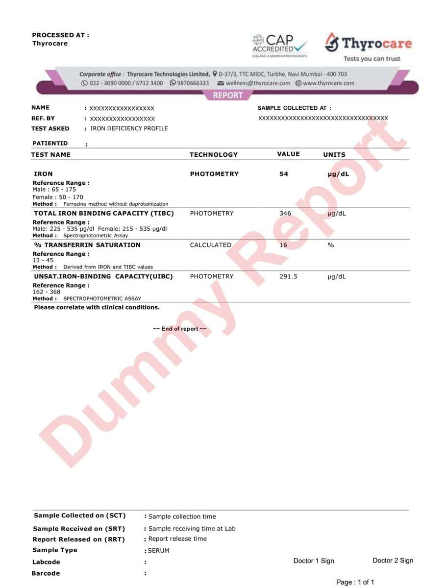 Sample Report of the Iron Deficiency Profile showing Serum Iron, TIBC, UIBC, and Transferrin Saturation