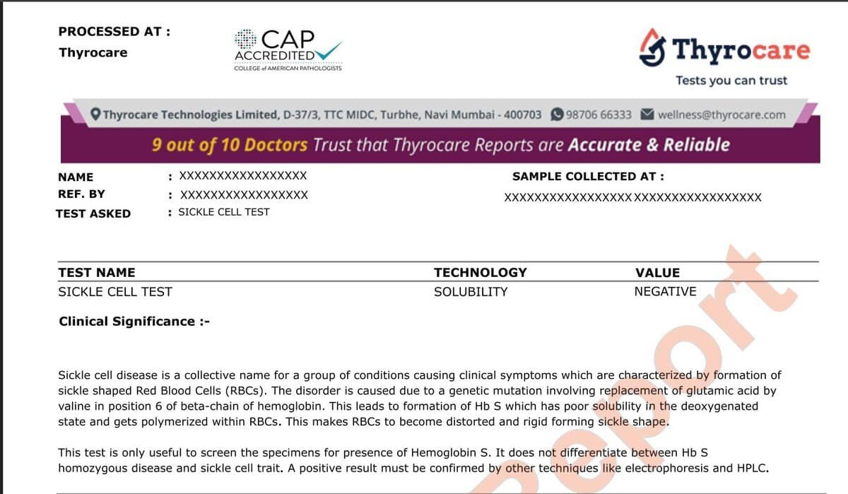 Sickle Cell, Thalassemia, Hb HPLC, & Hb Electrophoresis Tests at Low Cost Sample sickle cell blood test report
